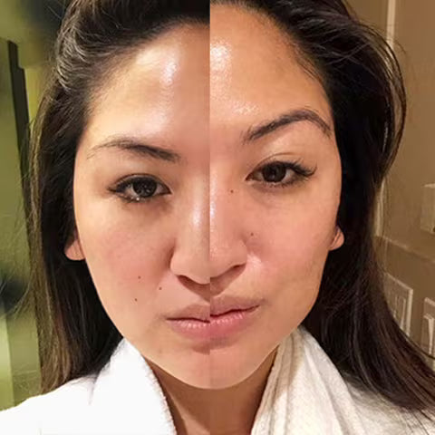 Appareil de beauté pour le cou et le visage : thérapie photonique LED colorée, raffermissement de la peau, réduction du double menton, anti-rides, effet liftant.